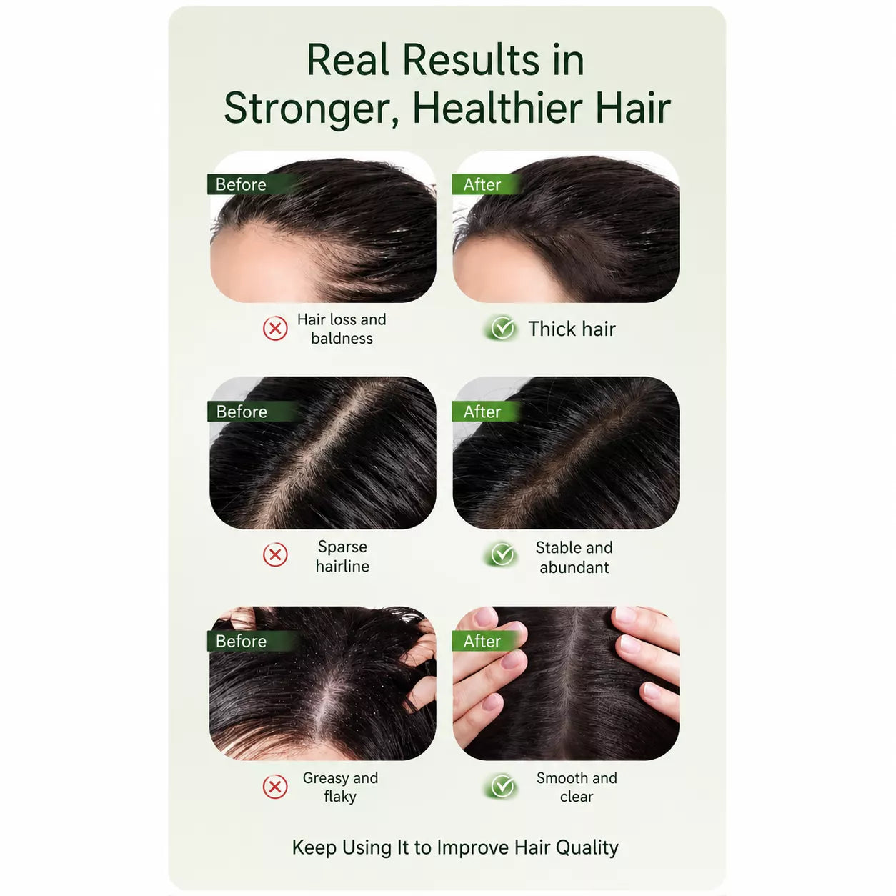 Rootiva Seven Green Anti-Hair Loss Shampoo Bar