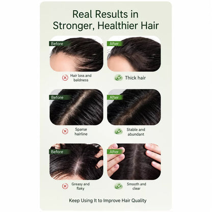 Rootiva Seven Green Anti-Hair Loss Shampoo Bar